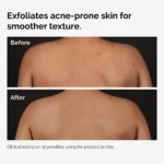 Acido Salicilico 0.5% Cuerpo Serum (240 ml) - Image 2